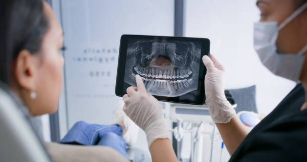 Licensed Tooth Extraction service in South Pasadena, CA - Smile Center Dentistry